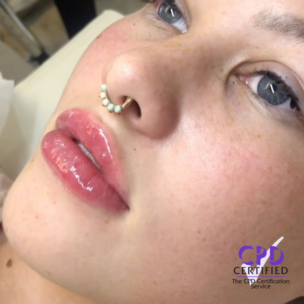 DF2 - Dermal Filler Masterclass (Russian Lips & Nose)